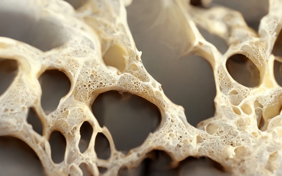 Focus on the use of collagen matrix in guided bone regeneration