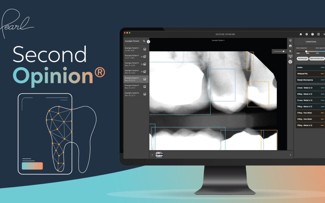 FDA Clears World’s First AI Software to Read Dental X-Rays