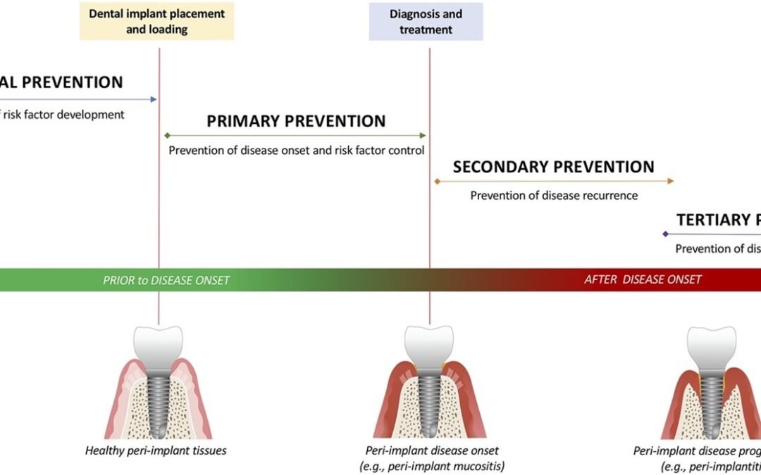 The European Federation of Periodontology (EFP) have released S3 level clinical practice guideline